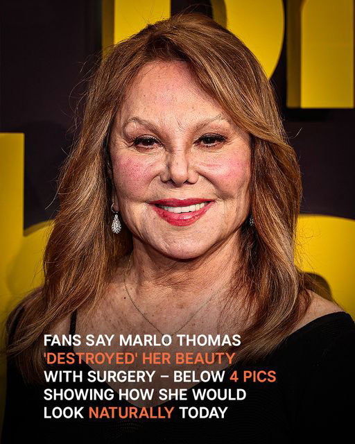 HT1. Fans Say Marlo Thomas ‘Destroyed’ Her Beauty with Surgery: How She Would Look Today Naturally